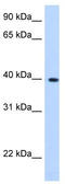 Lipoic Acid Synthetase antibody, TA346756, Origene, Western Blot image 