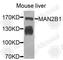 Mannosidase Alpha Class 2B Member 1 antibody, A9937, ABclonal Technology, Western Blot image 