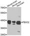 F-Box Protein 2 antibody, A8579, ABclonal Technology, Western Blot image 