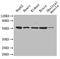 Insulin Like Growth Factor Binding Protein 1 antibody, A50302-100, Epigentek, Western Blot image 