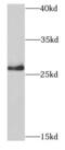 Proteasome Subunit Beta 10 antibody, FNab06869, FineTest, Western Blot image 