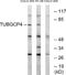 Tubulin Gamma Complex Associated Protein 4 antibody, A30692, Boster Biological Technology, Western Blot image 