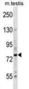 BR Serine/Threonine Kinase 2 antibody, abx028574, Abbexa, Western Blot image 