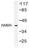 Neuromedin B Receptor antibody, AP01274PU-N, Origene, Western Blot image 