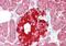 Phosphoglycerate Dehydrogenase antibody, ARP54801_P050, Aviva Systems Biology, Immunohistochemistry frozen image 
