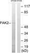 P21 (RAC1) Activated Kinase 2 antibody, LS-C118318, Lifespan Biosciences, Western Blot image 