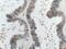 Cathepsin K antibody, 14296-1-AP, Proteintech Group, Immunohistochemistry frozen image 