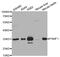 Proteasome Inhibitor Subunit 1 antibody, MBS2523907, MyBioSource, Western Blot image 