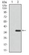 ATP Binding Cassette Subfamily G Member 5 antibody, TA336947, Origene, Western Blot image 