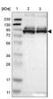 THAP Domain Containing 12 antibody, NBP1-85312, Novus Biologicals, Western Blot image 