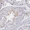 NUT Midline Carcinoma Family Member 1 antibody, NBP1-84176, Novus Biologicals, Immunohistochemistry paraffin image 