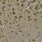 Leucine Rich Glioma Inactivated 1 antibody, abx006776, Abbexa, Western Blot image 