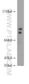 Forkhead Box P2 antibody, 20529-1-AP, Proteintech Group, Western Blot image 