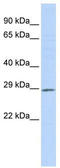 Proteasome assembly chaperone 1 antibody, TA338920, Origene, Western Blot image 