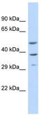 Cytochrome P450 Family 2 Subfamily A Member 7 antibody, TA346222, Origene, Western Blot image 