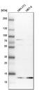 Profilin 2 antibody, HPA035611, Atlas Antibodies, Western Blot image 
