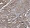 Coronin 2B antibody, FNab01884, FineTest, Immunohistochemistry paraffin image 