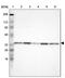 NADH-cytochrome b5 reductase 3 antibody, PA5-51601, Invitrogen Antibodies, Western Blot image 