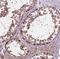 Nudix Hydrolase 1 antibody, NBP2-54664, Novus Biologicals, Immunohistochemistry paraffin image 