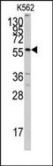 Cytochrome P450 Family 7 Subfamily A Member 1 antibody, AP14901PU-N, Origene, Western Blot image 