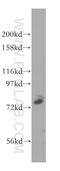 N-acetylgalactosaminyltransferase 7 antibody, 13962-1-AP, Proteintech Group, Western Blot image 