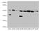 Integrin-linked protein kinase antibody, A52452-100, Epigentek, Western Blot image 