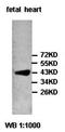 PIP5K2beta antibody, orb77751, Biorbyt, Western Blot image 
