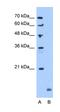 Matrix Metallopeptidase 23B antibody, orb330493, Biorbyt, Western Blot image 