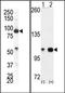 EPH Receptor A4 antibody, AP14279PU-N, Origene, Western Blot image 