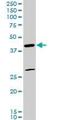 Forkhead box protein F2 antibody, H00002295-M03, Novus Biologicals, Western Blot image 