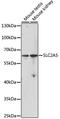 Solute Carrier Family 2 Member 5 antibody, 15-128, ProSci, Western Blot image 