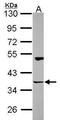 Homer Scaffold Protein 3 antibody, GTX115242, GeneTex, Western Blot image 