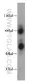 HEP antibody, 16673-1-AP, Proteintech Group, Western Blot image 