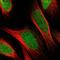 Ellis-van Creveld syndrome protein antibody, HPA016046, Atlas Antibodies, Immunofluorescence image 