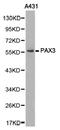 Paired Box 3 antibody, TA327135, Origene, Western Blot image 