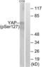 Yes Associated Protein 1 antibody, LS-C199738, Lifespan Biosciences, Western Blot image 