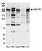 HEAT repeat-containing protein 1 antibody, A305-082A, Bethyl Labs, Western Blot image 