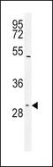 Solute Carrier Family 25 Member 1 antibody, PA5-25403, Invitrogen Antibodies, Western Blot image 