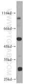 Dipeptidyl Peptidase 7 antibody, 19018-1-AP, Proteintech Group, Western Blot image 