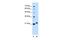 Chromosome 1 Open Reading Frame 159 antibody, GTX46317, GeneTex, Western Blot image 