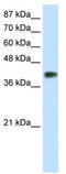 Homeobox protein DLX-3 antibody, TA343516, Origene, Western Blot image 