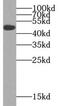 Vascular Endothelial Growth Factor C antibody, FNab09866, FineTest, Western Blot image 