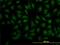 Decapping Enzyme, Scavenger antibody, H00028960-M02, Novus Biologicals, Immunofluorescence image 