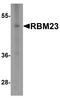 RNA Binding Motif Protein 23 antibody, TA355026, Origene, Western Blot image 