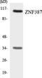 Suppression of tumorigenicity 18 protein antibody, LS-B14714, Lifespan Biosciences, Western Blot image 