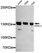 Histone Deacetylase 4 antibody, STJ99035, St John