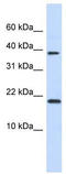 Chromatin Accessibility Complex Subunit 1 antibody, TA331896, Origene, Western Blot image 