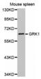 Rhodopsin kinase antibody, abx002158, Abbexa, Western Blot image 