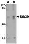 Serine/Threonine Kinase 39 antibody, AP22996PU-N, Origene, Western Blot image 