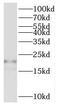 Ras antibody, FNab05849, FineTest, Western Blot image 